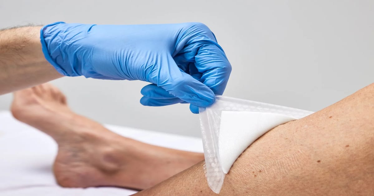 Foam Dressings
