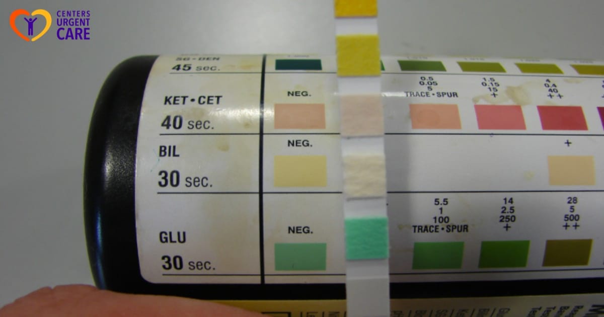 Urine Test Strips