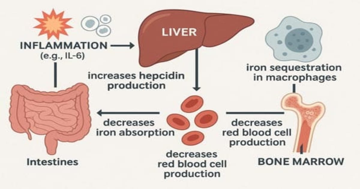 Iron and hematinic formulations designed to prevent and manage iron-deficiency anemia across adult, pediatric, and geriatric populations.