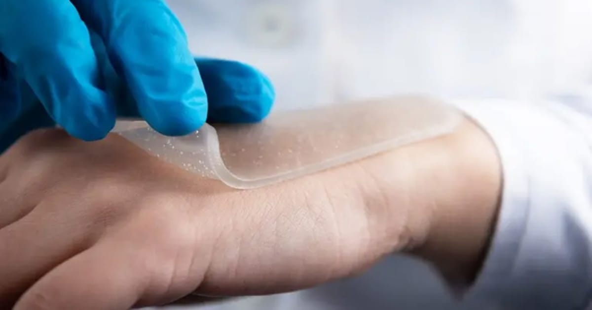 Hydrogel Dressings
